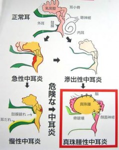 ～日耳鼻宮城県地方部会より～