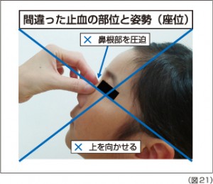 間違った止血方法～広島県医師会より～